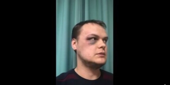 Журналіста побили після скарги у поліцію на порушення карантину