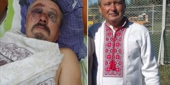 На Донеччині жорстко побили головного редактора місцевої газети