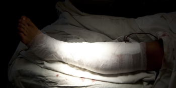 «Пройшло 10 днів, а досі не призначено навіть судово-медичної  експертизи», – про хід розслідування побиття журналіста