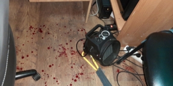 У Черкасах журналіст заявив про побиття чиновником через критичні матеріали