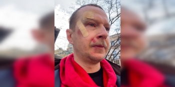 «Як МВС дізналося, що я – журналіст. Отоді почалось гуляння…», – Роман Вінтонів