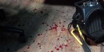 Від початку 2021 року зафіксовано 21 випадок фізичної агресії проти   журналістів, – НСЖУ