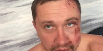 «Нападники діяли за вказівкою»: у Житомирі побили видавця газети, яка відома резонансними публікаціями (оновлено)