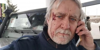 «Це не військові, це путінські вбивці», – швейцарський репортер, поранений на війні в Україні