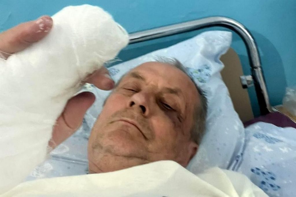Побитий на Одещині журналіст провів у лікарні майже два тижні