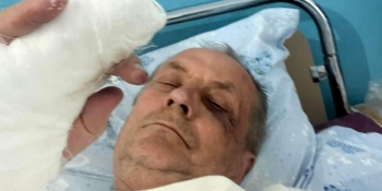 Побитий на Одещині журналіст провів у лікарні майже два тижні