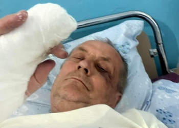 Побитий на Одещині журналіст провів у лікарні майже два тижні