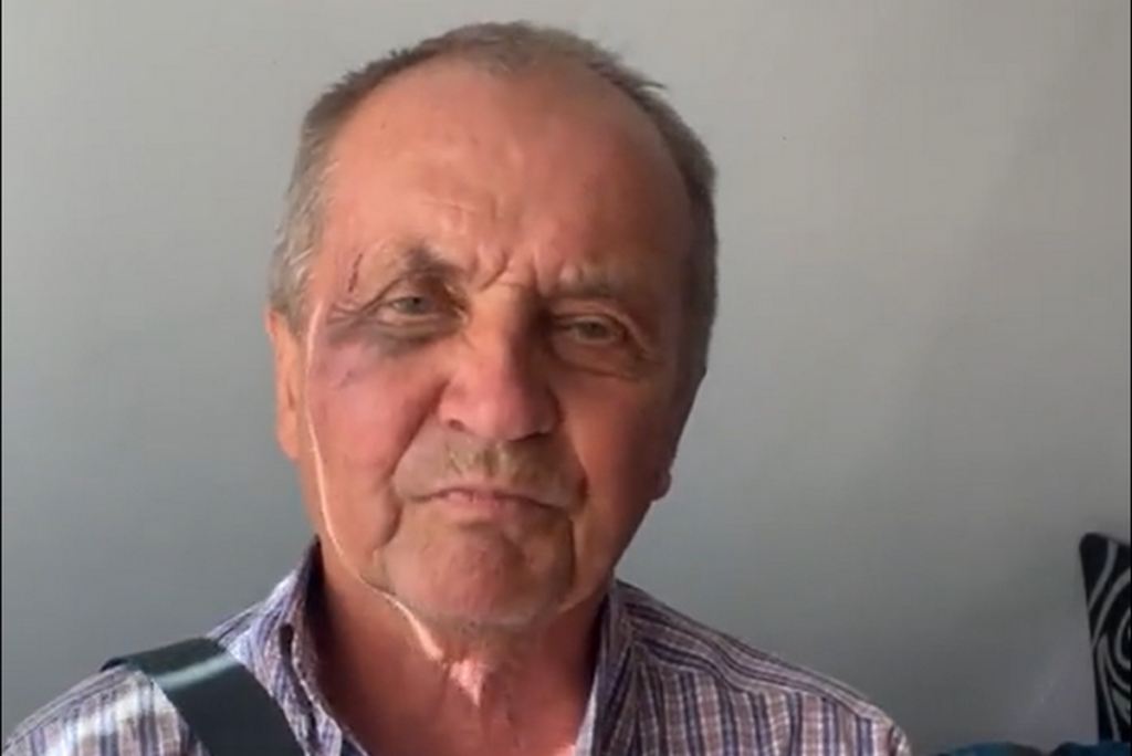 В Ананьєві на Одещині побили журналіста