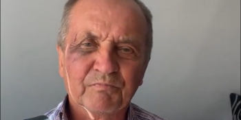 В Ананьєві на Одещині побили журналіста