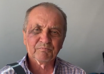 В Ананьєві на Одещині побили журналіста