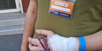 Під час ракетної атаки росіян на центр Чернігова постраждала родина журналістів