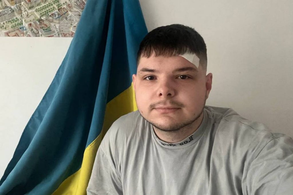 Під час сьогоднішнього ракетного обстрілу постраждав журналіст зі Львова
