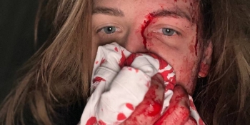 Від російських ракет, що вдарили по харківському готелю, постраждала українська фіксерка французької телекомпанії 21 Violetta-Anastasia Pedorich