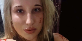 Моніка Андрушевська: «Моя перша кров, пролита за Україну» 25 Моніка Андрушевська: «Моя перша кров, пролита за Україну»