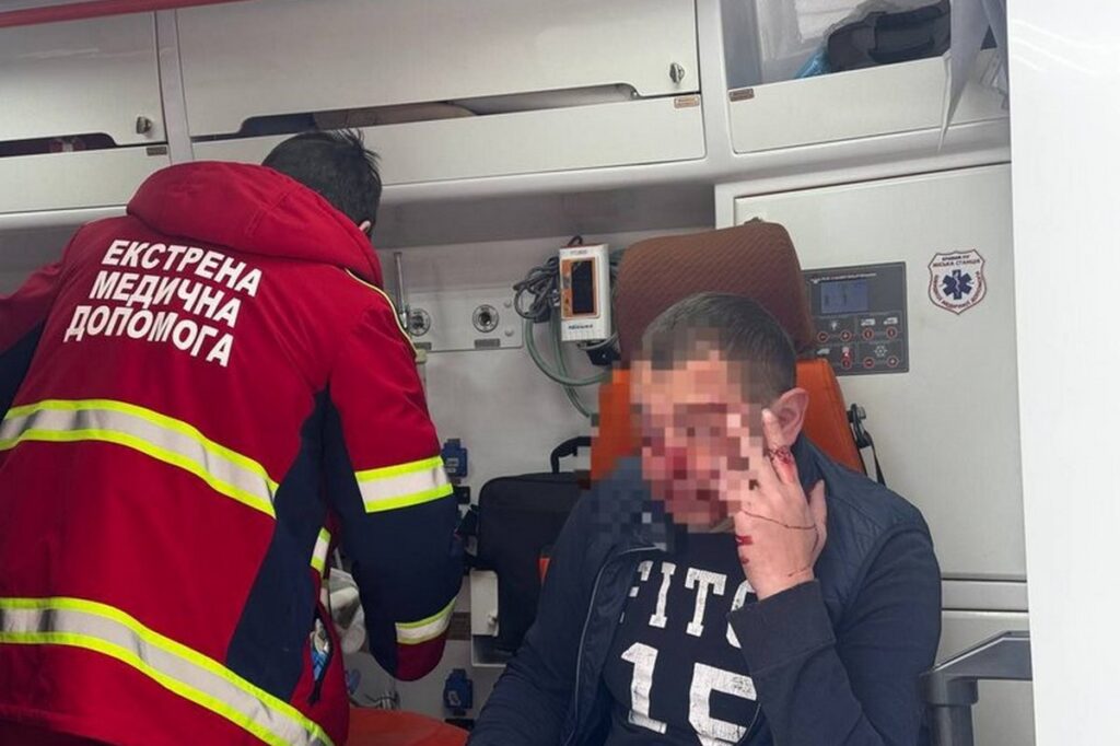 У Кривому Розі на журналіста онлайн-медіа здійснили напад