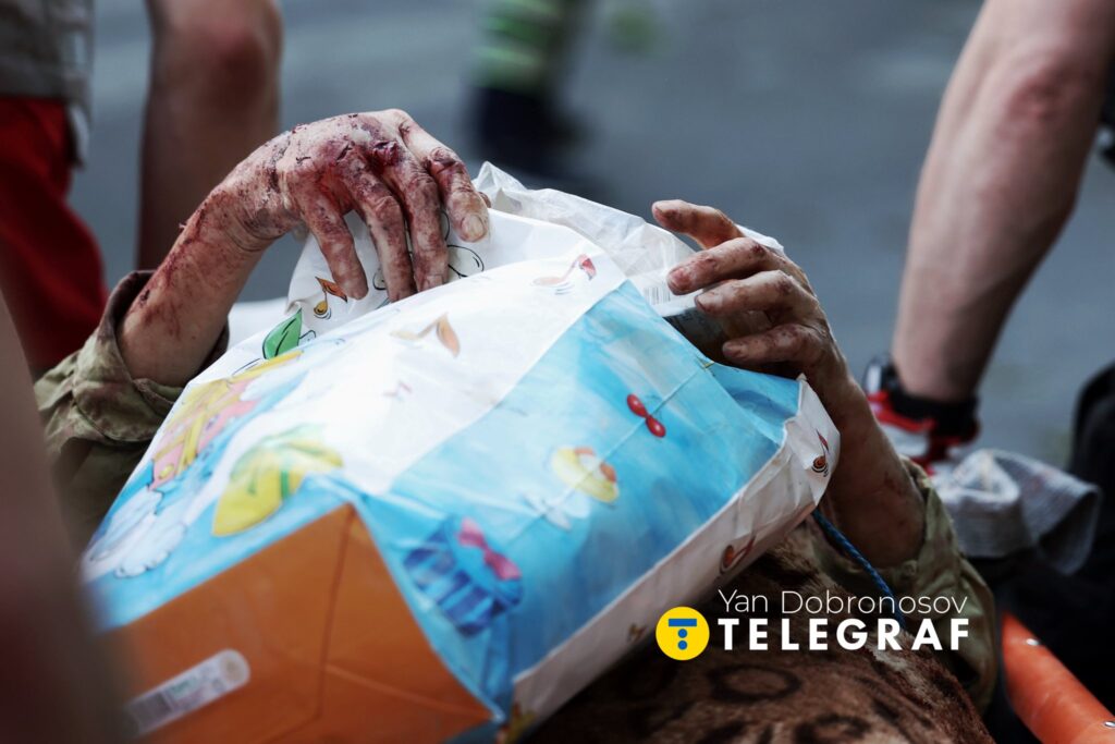 Війна через об’єктив фотоапарату: Ян Доброносов про зміни у фотожурналістиці під час російської агресії 19 Війна через об’єктив фотоапарату: Ян Доброносов про зміни у фотожурналістиці під час російської агресії 2