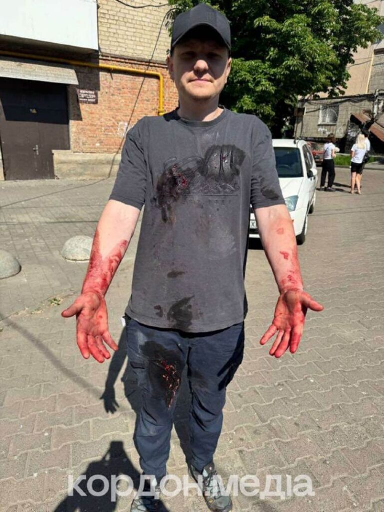 70 метрів до епіцентру. Історія воєнкора, який відклав камеру, щоб рятувати життя 21 70 метрів до епіцентру. Історія воєнкора, який відклав камеру, щоб рятувати життя 4
