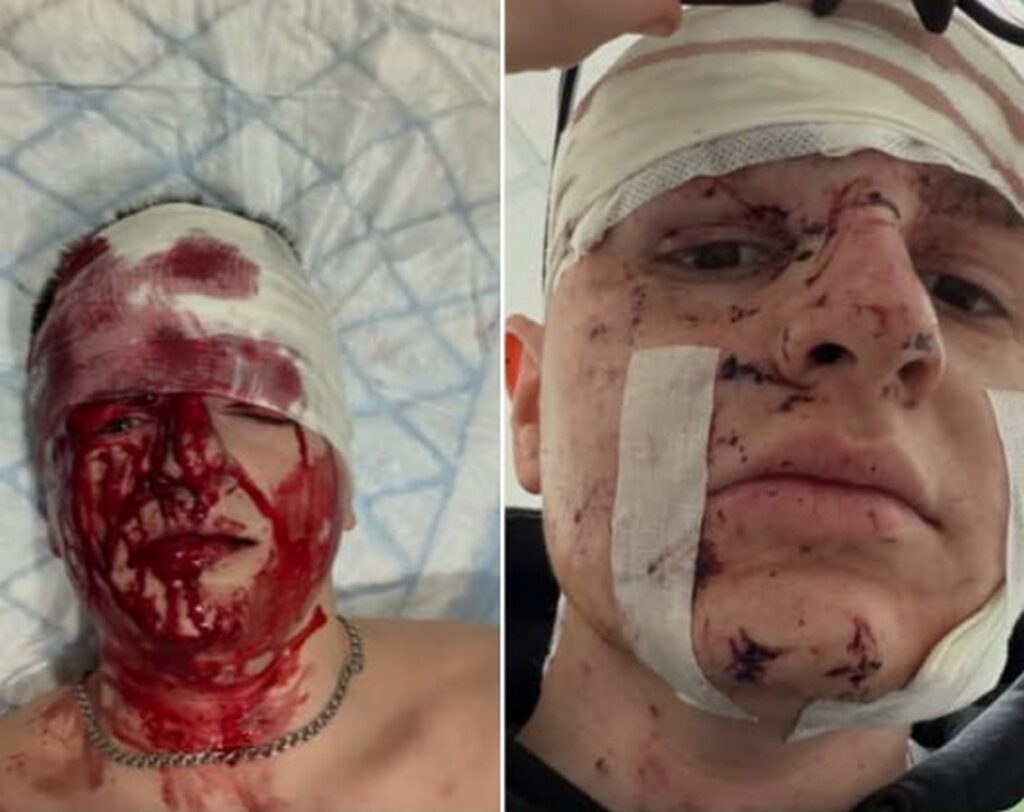 «Війна не може пройти осторонь»: на фронті поранено журналіста Богдана Флюнта