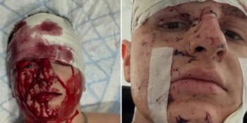 «Війна не може пройти осторонь»: на фронті поранено журналіста Богдана Флюнта