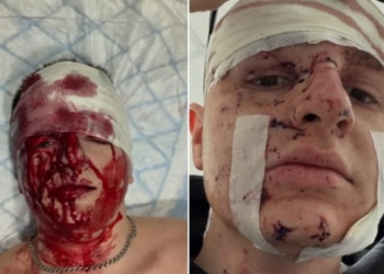«Війна не може пройти осторонь»: на фронті поранено журналіста Богдана Флюнта
