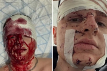 «Війна не може пройти осторонь»: на фронті поранено журналіста Богдана Флюнта