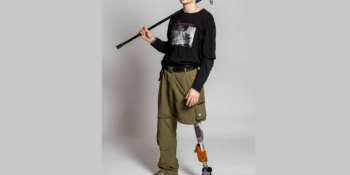 Тяжко поранений журналіст Георгій Іванченко: «Хочу знову працювати на передовій»