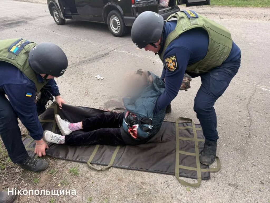 У Нікополі під час обстрілу важко поранено доньку члена НСЖУ
