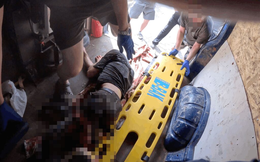 «Підбігла й побачила, що у нього немає ноги». Журналістка Суспільне Дніпро допомогла пораненому після удару РФ 5